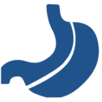 عمل باریاتریک