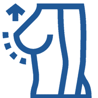 ماموپلاستی